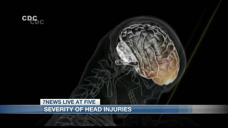 Dr. Shah at Christus Ochsner Lake Area Hospital shared his advice when it comes to head trauma.